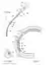 Fig. 47 - Living tissue ligation device