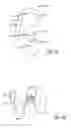 Fig. 02 - Silent effusion removal