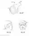 Fig. 06 - Silent effusion removal