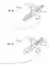 Fig. 08 - Silent effusion removal