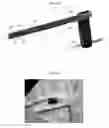 Fig. 06 - SURGICAL REMOVAL OF INTERNAL TISSUE