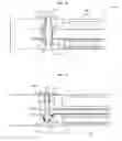 Fig. 07 - SURGICAL REMOVAL OF INTERNAL TISSUE