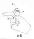 Fig. 04 - DISPOSABLE DIGITAL TOURNIQUETS AND RELATED METHODS OF PROVIDING OCCLUSION PRESSURES TO A SINGLE DIGIT DURING SURGICAL PROCEDURES