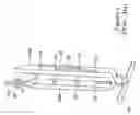 Fig. 02 - PLUG FOR ARTERIOTOMY CLOSURE AND METHOD OF USE