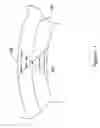 Fig. 02 - Modified plug for arteriotomy closure