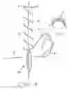 Fig. 07 - Suture treatment method and kit therefor