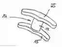 Fig. 01 - VERTEBRAL IMPLANT MADE FROM BONE MATERIAL FOR RELIEF OF A NARROWED VERTEBRAL CHANNEL