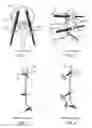 Fig. 02 - Expandable spinal support device with attachable members and methods of use