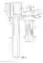 Fig. 06 - System for treating proximal humeral fractures and method of using the same