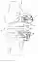 Fig. 01 - Patient specific surgical guide locator and mount