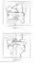 Fig. 04 - Patient specific surgical guide locator and mount