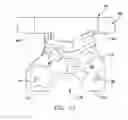 Fig. 09 - Patient specific surgical guide locator and mount