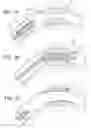 Fig. 02 - Bioerodible Endoprosthesis