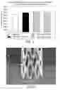Fig. 07 - Bioerodible Endoprosthesis