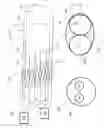Fig. 02 - Device, System, and Method for Aiding Stent Valve Deployment