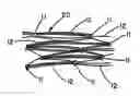 Fig. 01 - Intraluminal stent graft
