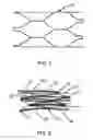 Fig. 02 - Intraluminal stent graft