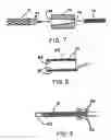 Fig. 05 - Intraluminal stent graft