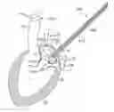 Fig. 01 - Method For Replacing Native Valve Function Of A Diseased Aortic Valve