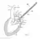 Fig. 02 - Method For Replacing Native Valve Function Of A Diseased Aortic Valve