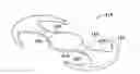 Fig. 01 - Accommodating intraocular lens and method of manufacture thereof