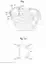 Fig. 02 - PROSTHETIC DEVICE, METHOD OF PLANNING BONE REMOVAL FOR IMPLANTATION OF PROSTHETIC DEVICE, AND ROBOTIC SYSTEM