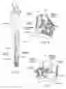 Fig. 02 - Fibular stiffener and bony defect replacer