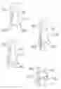 Fig. 07 - Fibular stiffener and bony defect replacer