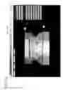Fig. 02 - Scanning dental models