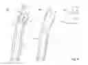 Fig. 08 - Pole grip