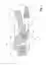Fig. 02 - Clamping lock for a tensioning means