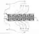 Fig. 01 - Packaging substrate having pattern-matched metal layers