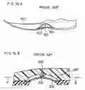 Fig. 16 - Shoe sole with reinforcement structure