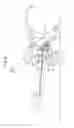 Fig. 08 - Two-stage snow plow