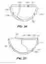 Fig. 19 - Vibration damping device and bucket for construction machine