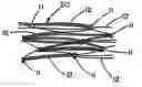Fig. 01 - Intraluminal stent graft