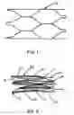Fig. 02 - Intraluminal stent graft