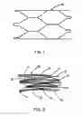 Fig. 02 - Intraluminal Stent Graft