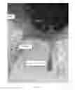 Fig. 23 - Methods and Apparatus for Mechanical and Thermal Drilling