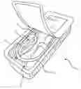 Fig. 01 - Two-part package for medical implant