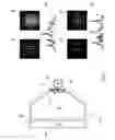 Fig. 07 - Combination of single photon emission computed tomography and optical imaging detector