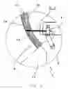 Fig. 04 - PROCESS AND DEVICE FOR PRODUCING A MOLDING WITH A PREDETERMINED RUPTURE LINE FOR AN AIRBAG OPENING