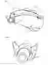 Fig. 03 - HEARING DEVICE WITH AN ACOUSTICS UNIT AND A SHELL PART