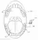 Fig. 01 - ACTUATOR SYSTEMS FOR ORAL-BASED APPLIANCES