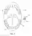 Fig. 02 - ACTUATOR SYSTEMS FOR ORAL-BASED APPLIANCES