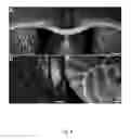 Fig. 07 - IN VIVO IMAGING OF MYELINATION