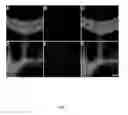 Fig. 08 - IN VIVO IMAGING OF MYELINATION