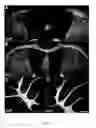 Fig. 09 - IN VIVO IMAGING OF MYELINATION