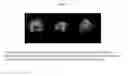 Fig. 02 - Ligands for imaging cardiac innervation