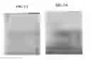 Fig. 03 - ENZYME DISRUPTION OF BACTERIAL BIOFILMS